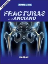 Tome Fracturas en el Anciano - Handbook