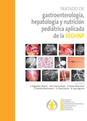 TRATADO DE gastroenterología, hepatología y nutrición pediátrica aplicada de la SEGHNP
