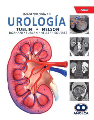 Imagenología en Urología - Tublin1