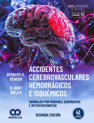 Accidentes cerebrovasculares hemorragicos e isquemicos. Vendok y Batjer