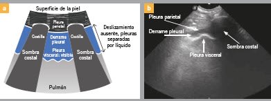 Ecografía pulmonar y pleural en la atención de urgencias en perros y gatos2