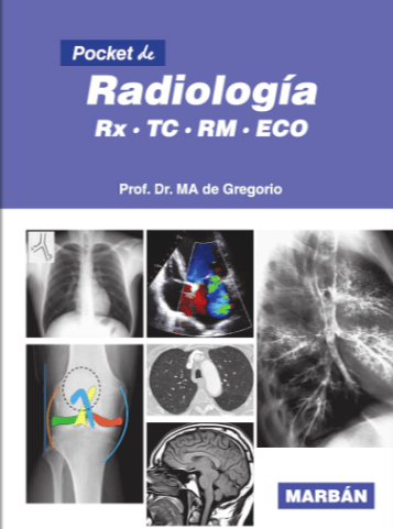 De Gregorio, Pocket de Radiologia 3a ed. 0