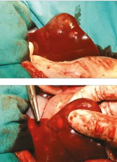 Cirugía en la clínica de pequeños animales. El abdomen craneal 2ª ed.2