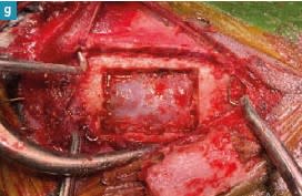 Neurocirugía en el perro y el gato2