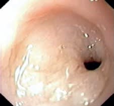 Gastroenterología felina2