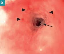 Gastroenterología felina3