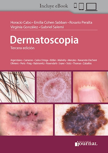Cabo Dermatoscopia 3° ed2