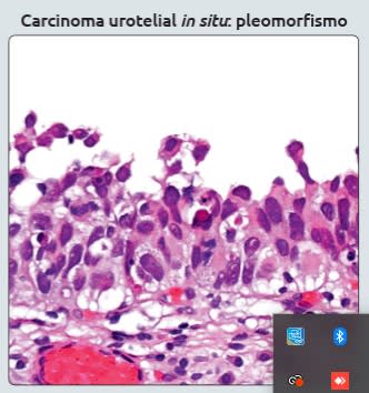 Diagnostico Patologico Genitourinario Amin, M..1