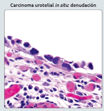 Diagnostico Patologico Genitourinario Amin, M..2