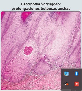 Diagnostico Patologico Genitourinario Amin, M..3