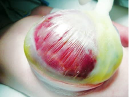 Blesa, Pediatria Quirurgica y de Urgencias Tapa dura5