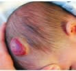 Blesa, Pediatria Quirurgica y de Urgencias Tapa dura2