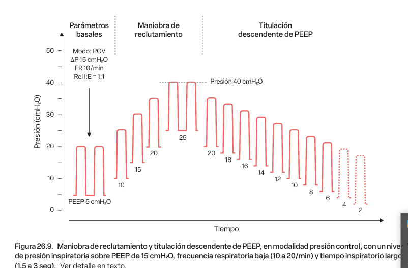 Insuficiencia respiratoria y ventilación mecánica, Gullermo Bugedo4