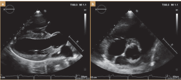 BUSSADORI MEDICINA CARDIOVASCULAR EN PERROS Y GATOS4