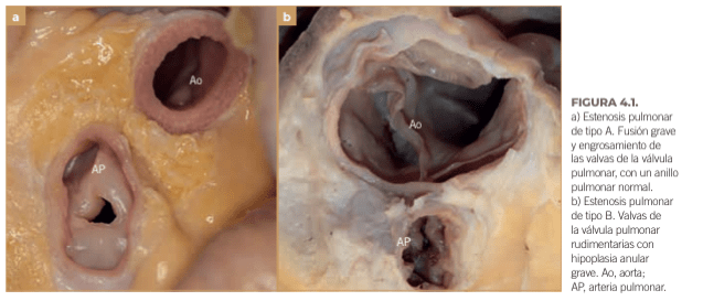 BUSSADORI MEDICINA CARDIOVASCULAR EN PERROS Y GATOS13