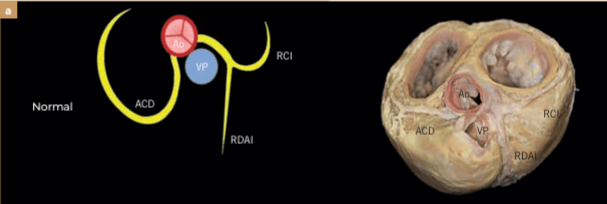 BUSSADORI MEDICINA CARDIOVASCULAR EN PERROS Y GATOS12
