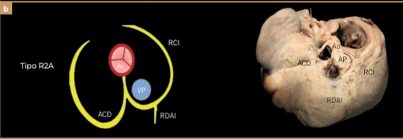 BUSSADORI MEDICINA CARDIOVASCULAR EN PERROS Y GATOS11