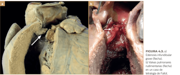 BUSSADORI MEDICINA CARDIOVASCULAR EN PERROS Y GATOS10