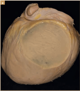 BUSSADORI MEDICINA CARDIOVASCULAR EN PERROS Y GATOS9