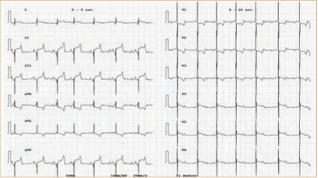 BUSSADORI MEDICINA CARDIOVASCULAR EN PERROS Y GATOS6