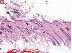 Casos clínicos complejos en dermatología de pequeños animales5