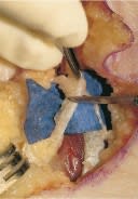 Chang Técnicas Quirúrgicas en Pie y Tobillo3