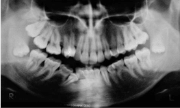 Manual ilustrado de cirugía oral (4ª edición)5