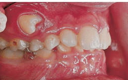 Manual ilustrado de cirugía oral (4ª edición)6