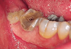Manual ilustrado de cirugía oral (4ª edición)4