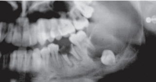 Manual ilustrado de cirugía oral (4ª edición)3