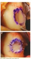 Tratado COT rodilla 5.14