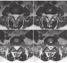 De Gregorio Anatomia Radiologica2