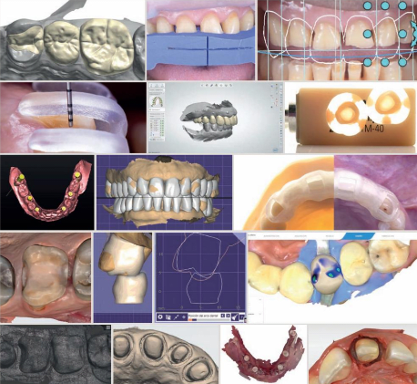 Introducción a la odontología digital2