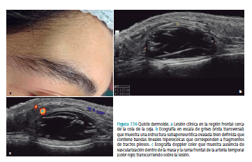 Ecografia Dermatologica Ximena Wortsman2