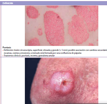 Ecografia Dermatologica Ximena Wortsman3