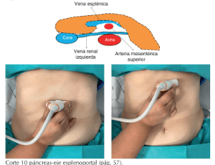ECOMÉCUM - Ecografía Clínica Handbook5