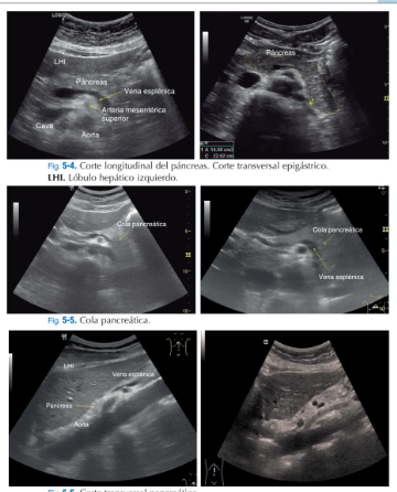 ECOMÉCUM - Ecografía Clínica Handbook4