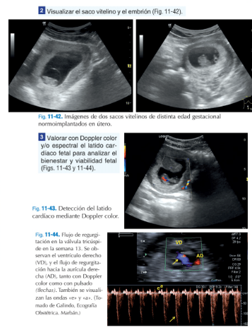 ECOMÉCUM - Ecografía Clínica Handbook2
