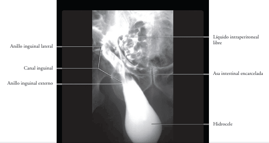 FEDERLE, Imagenologia Anatomica: Torax, Abdomen, Pelvis1