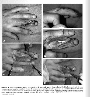 Green's cirugía de la mano 2 Vols Handbook4