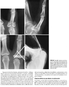 Green's cirugía de la mano 2 Vols Handbook3