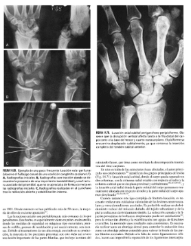 Green's cirugía de la mano 2 Vols Handbook1
