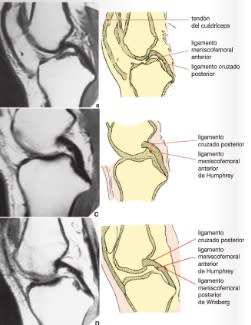 Greenspan, Ortopedia y Fracturas - Handbook1