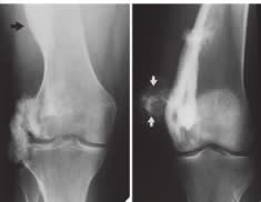 Greenspan, Ortopedia y Fracturas - Handbook2