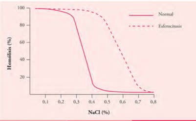 Hematologia. Manual Basico Razonado Sanchez-Guijo,  San Miguel.2