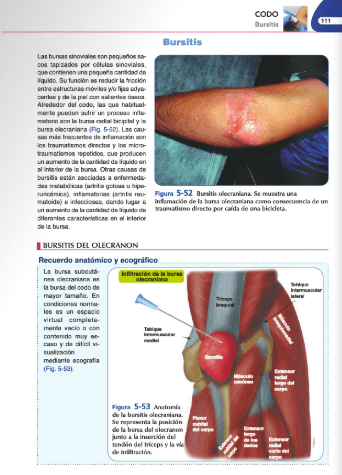 Jiménez Díaz Infiltraciones Ecoguiadas5
