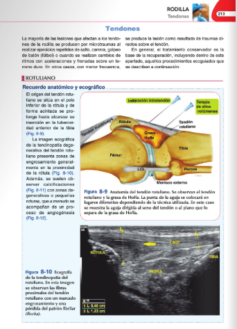 Jiménez Díaz Infiltraciones Ecoguiadas4