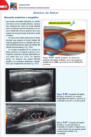 Jiménez Díaz Infiltraciones Ecoguiadas3