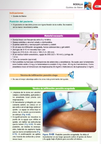 Jiménez Díaz Infiltraciones Ecoguiadas2