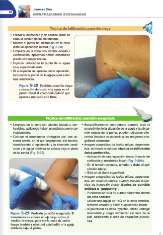 Jiménez Díaz Infiltraciones Ecoguiadas1